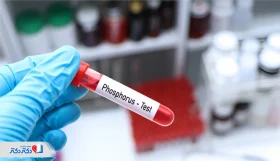 هرآنچه باید درباره آزمایش فسفر (phosphorus) بدانید!