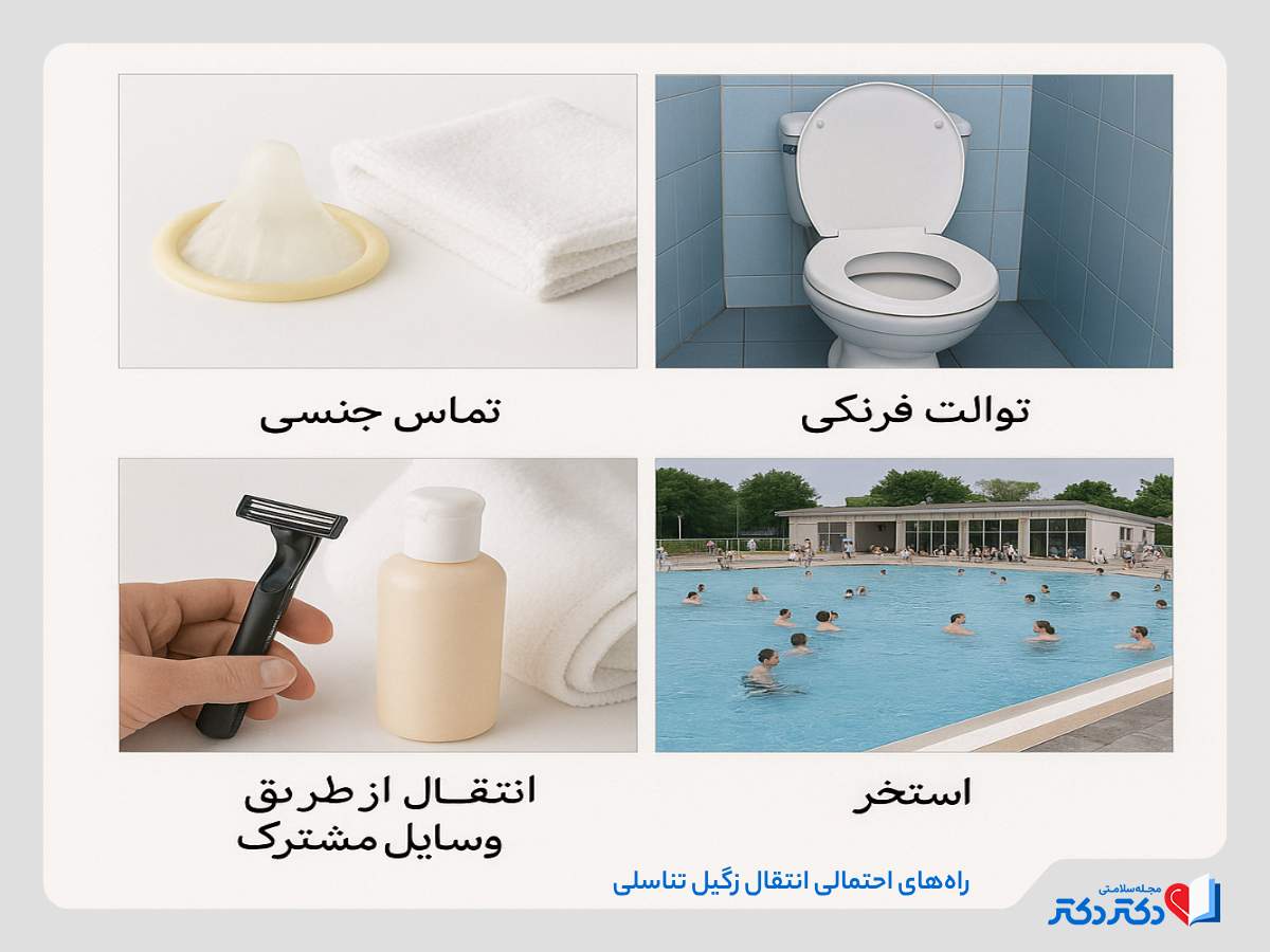 راه های انتقال زگیل تناسلی