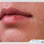دستورالعمل‌های کاربردی و پزشکی برای روتین پوست خشک