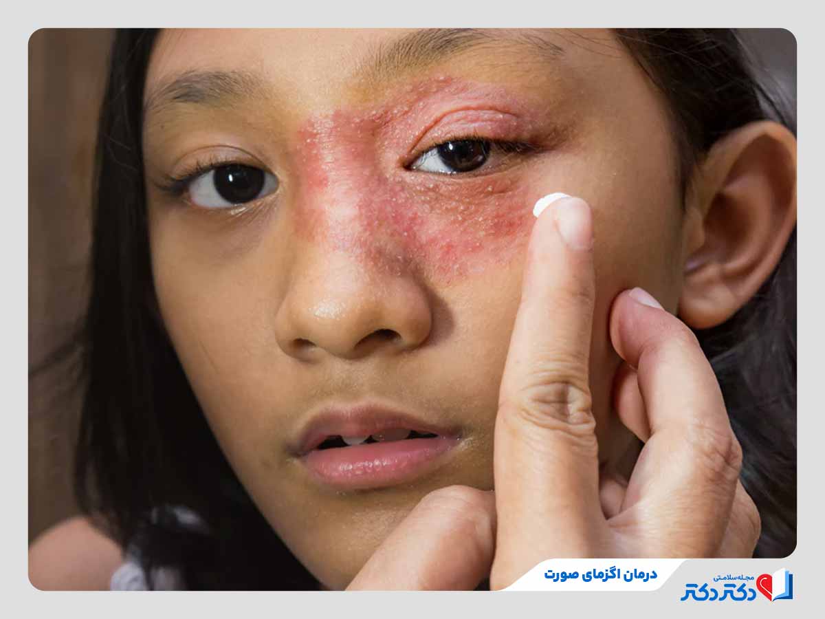 فرد در حال درمان اگزما در ناحیه صورت