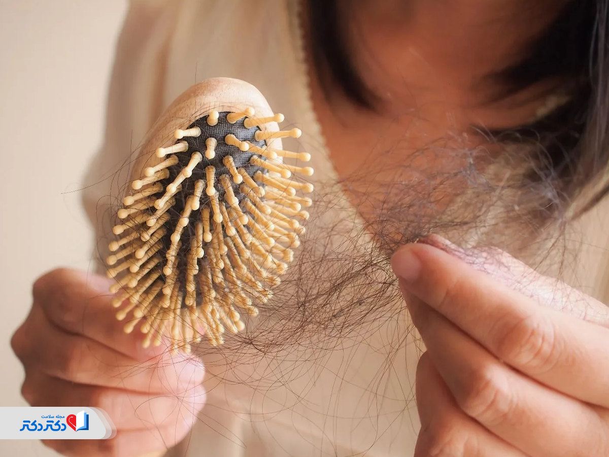 ریزش مو از عوارض جانبی داروی glp 1 برای لاغری