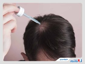محلول ماینوکسیدیل چیست؟ راهنمای کامل و کاربردی مصرف این دارو