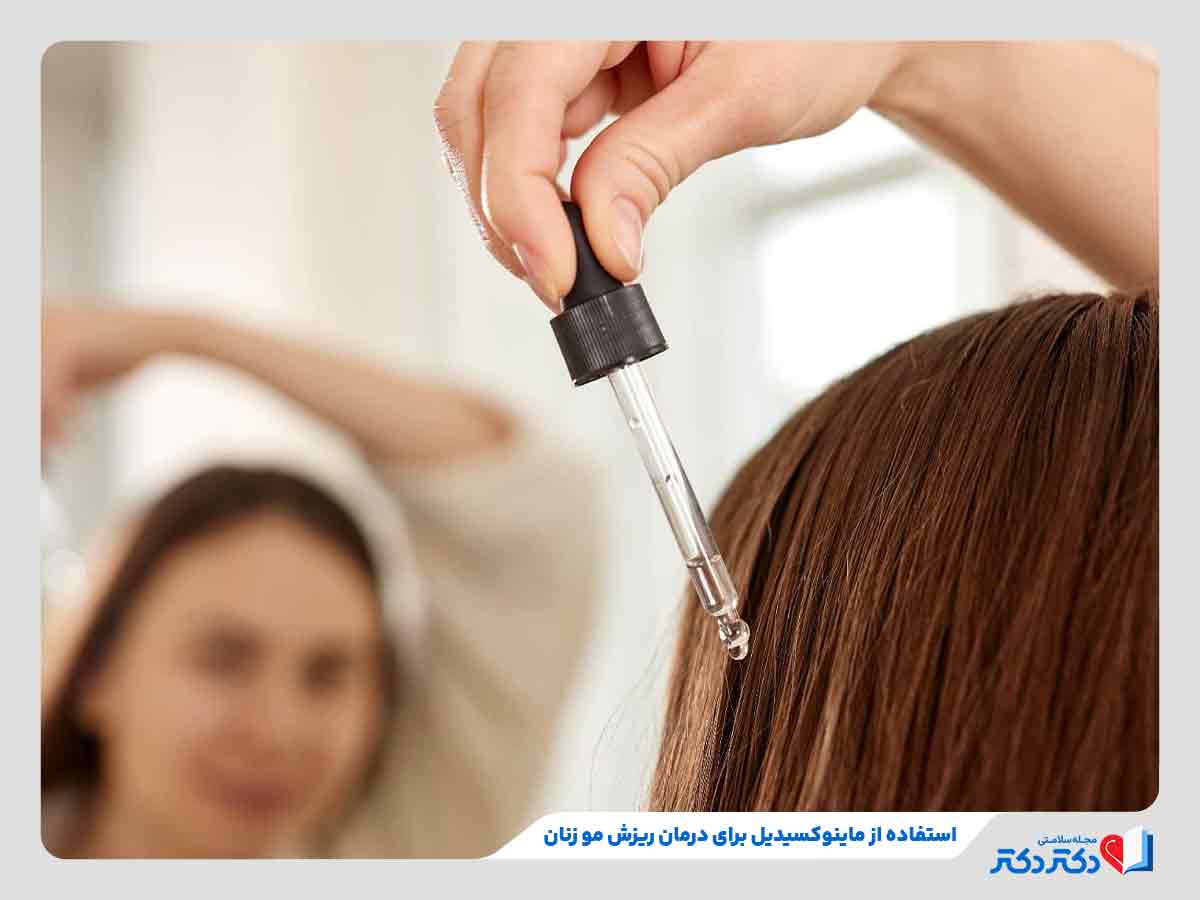 زن در حال استفاده از ماینوکسیدیل برای درمان ریزش مو زنان