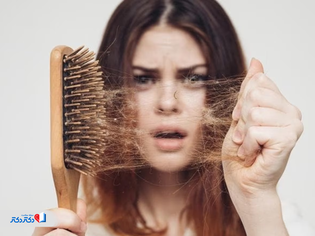 ریزش مو از عوارض رژیم شوک