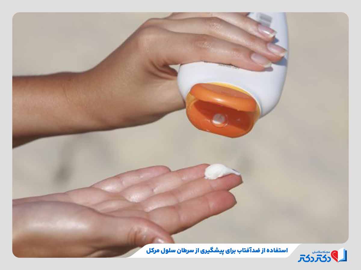 فرد در حال استفاده از ضدآفتاب برای پیشگیری از سلول مرکل پوست