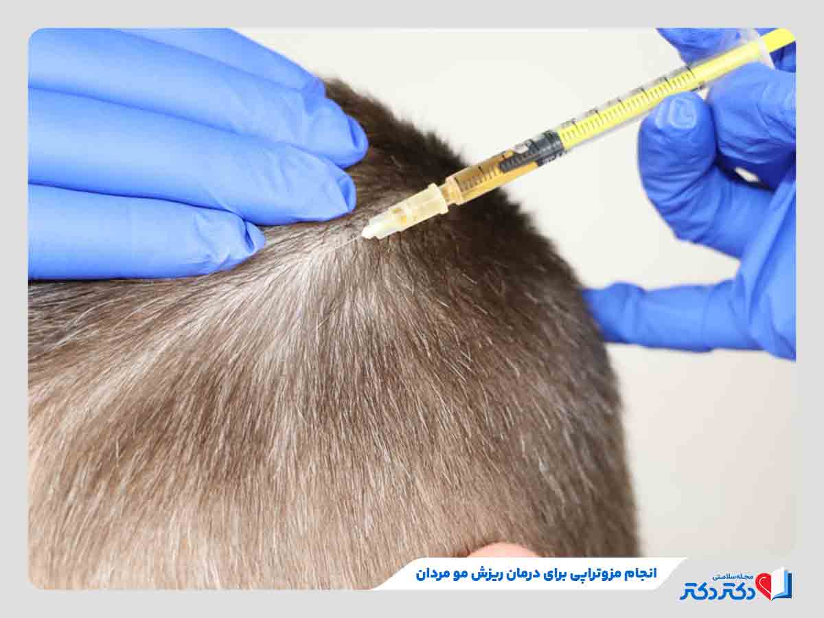 دکتر در حال انجام مزوتراپی برای درمان ریزش مو مردان