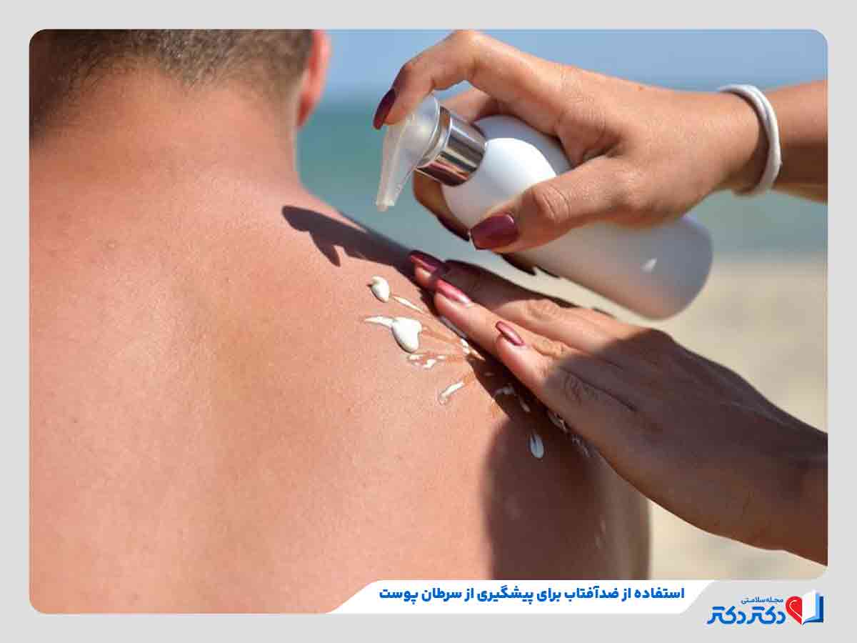 فرد در حال استفاده از ضدآفتاب برای جلوگیری از ابتلا به سرطان پوست