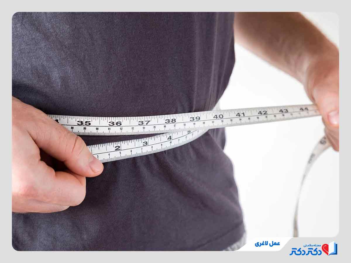 انجام انواع عمل لاغری برای کاهش وزن و سایز