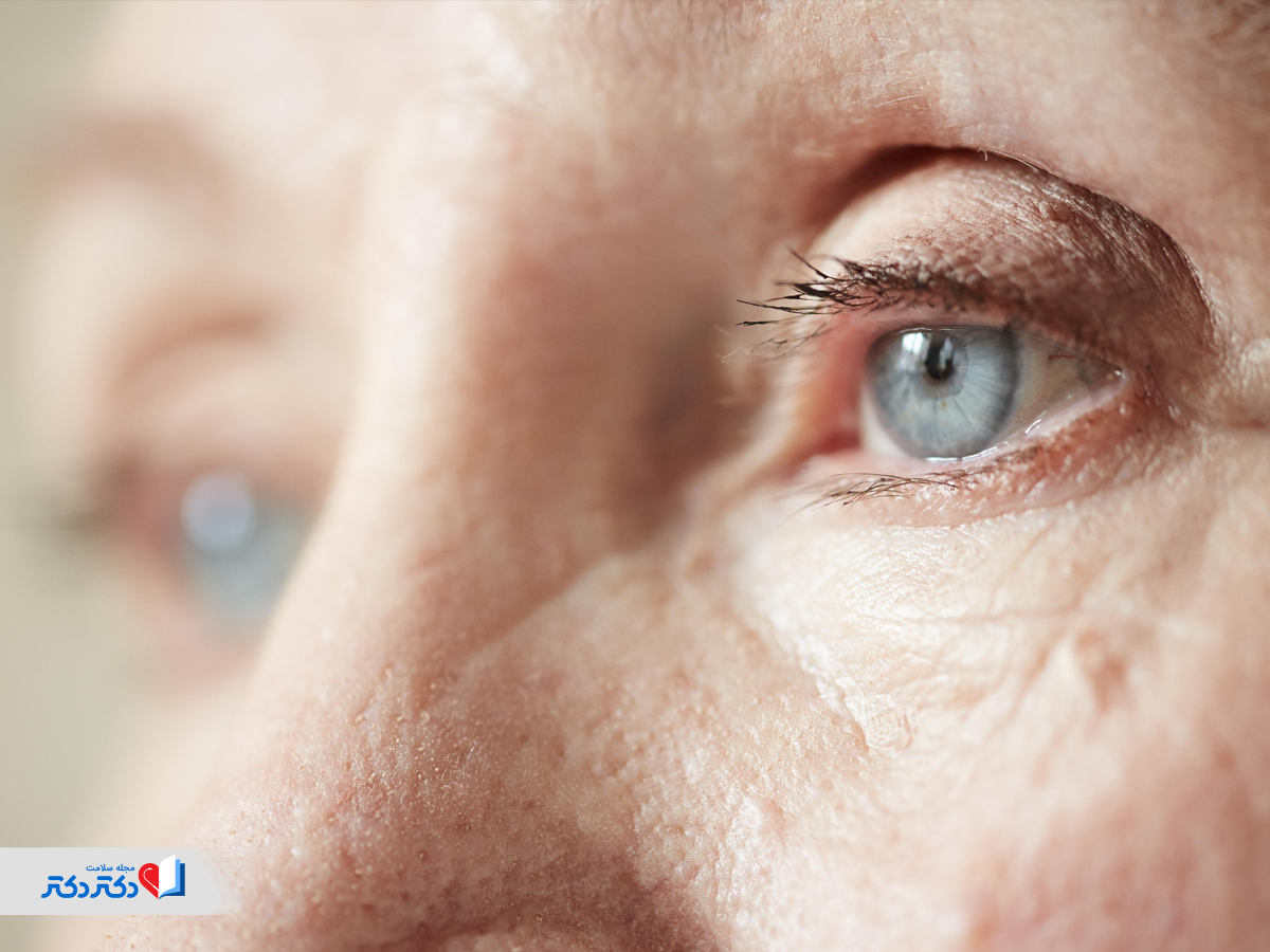 سلامت چشم و پیشگیری از دژنراسیون با مصرف مولتی ویتامین‌ها