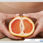 لابیاپلاستی چیست؟ + نکات مهم قبل و بعد از عمل