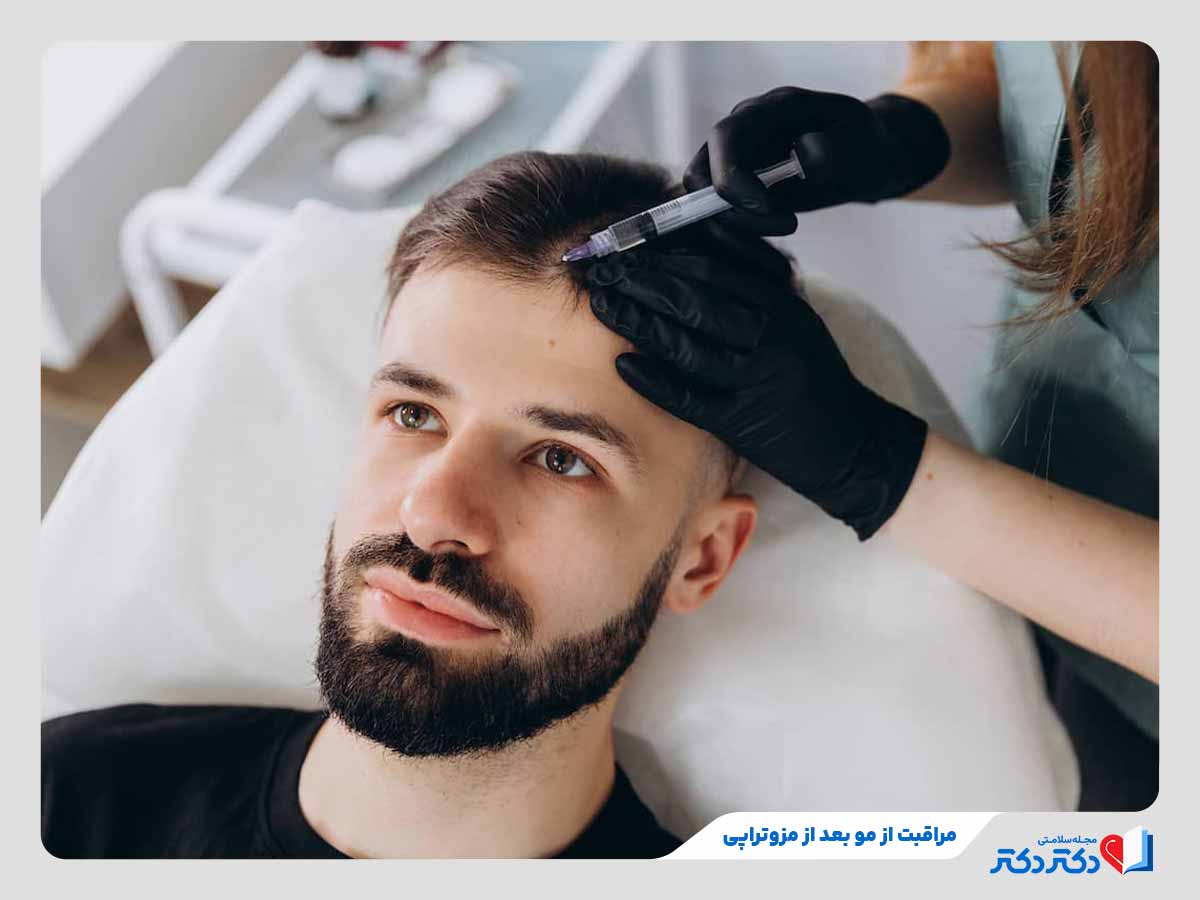 فرد در حال انجام مزوتراپی و نیازمند به روش های مراقبت از مو بقعد از مزوتراپی