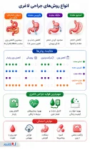 اینفوگرافی انواع عمل های لاغری 