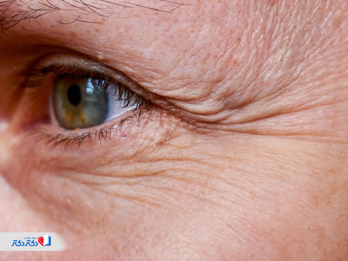 آنتیاکسیدانهای کمیاب در قارچ و جلوگیری از پیری زودرس