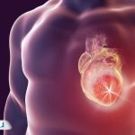 روماتیسم قلبی (تب روماتیسمی): علائم، علل، تشخیص و درمان