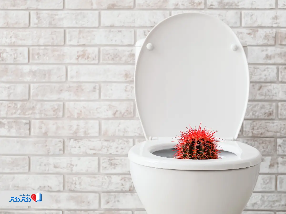 درد هنگام دفع بواسیر را آزاردهنده می‌کند.