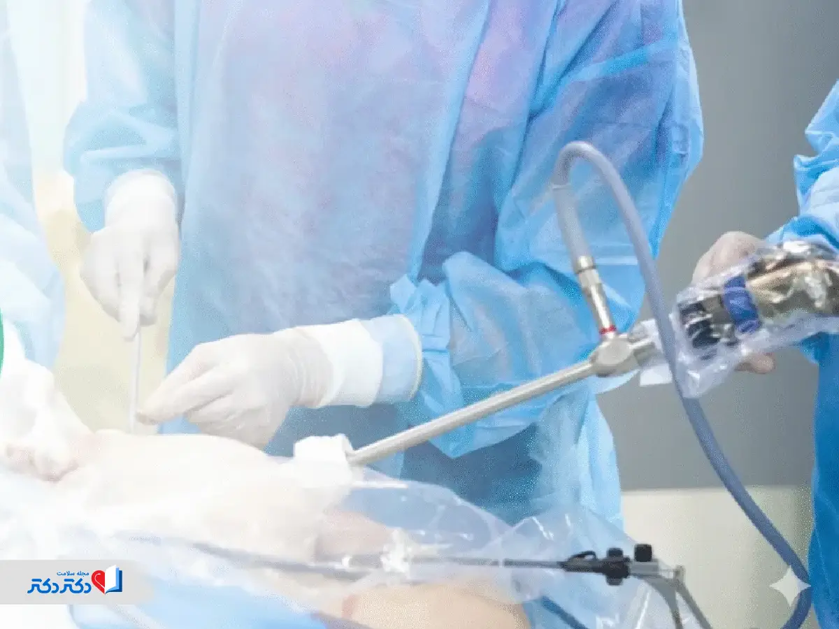 درمان قطعی بواسیر با لیزر