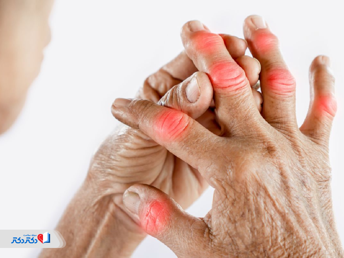 روماتسیم قلبی با مفصلی تفاوت دارد.