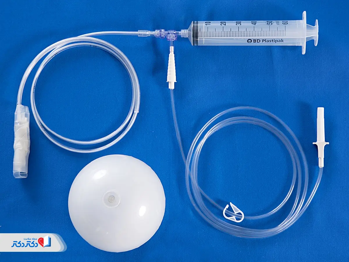 ادوات بالن معده