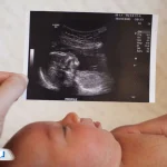 راهنمای کامل سونوگرافی آنومالی و تشخیص ناهنجاری‌های جنین