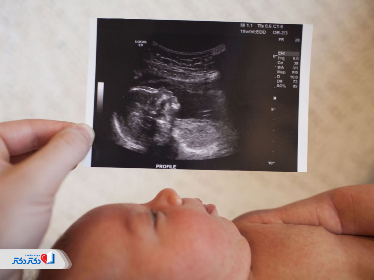 همه‌چیز درباره سونوگرافی آنومالی