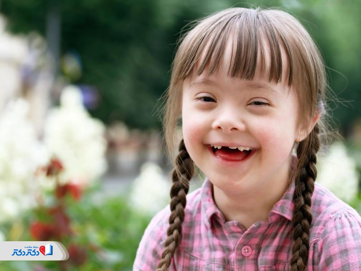 سندرم داون چیست؟