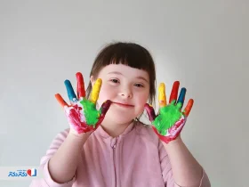 سندرم داون چیست و چه علائمی دارد | تشخیص، علت و طول عمر افراد مبتلا