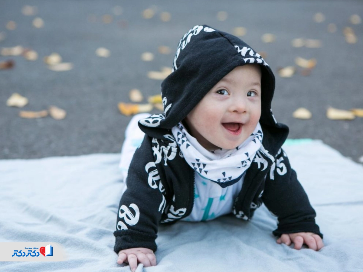 تشخیص سندرم داون بعد از تولد