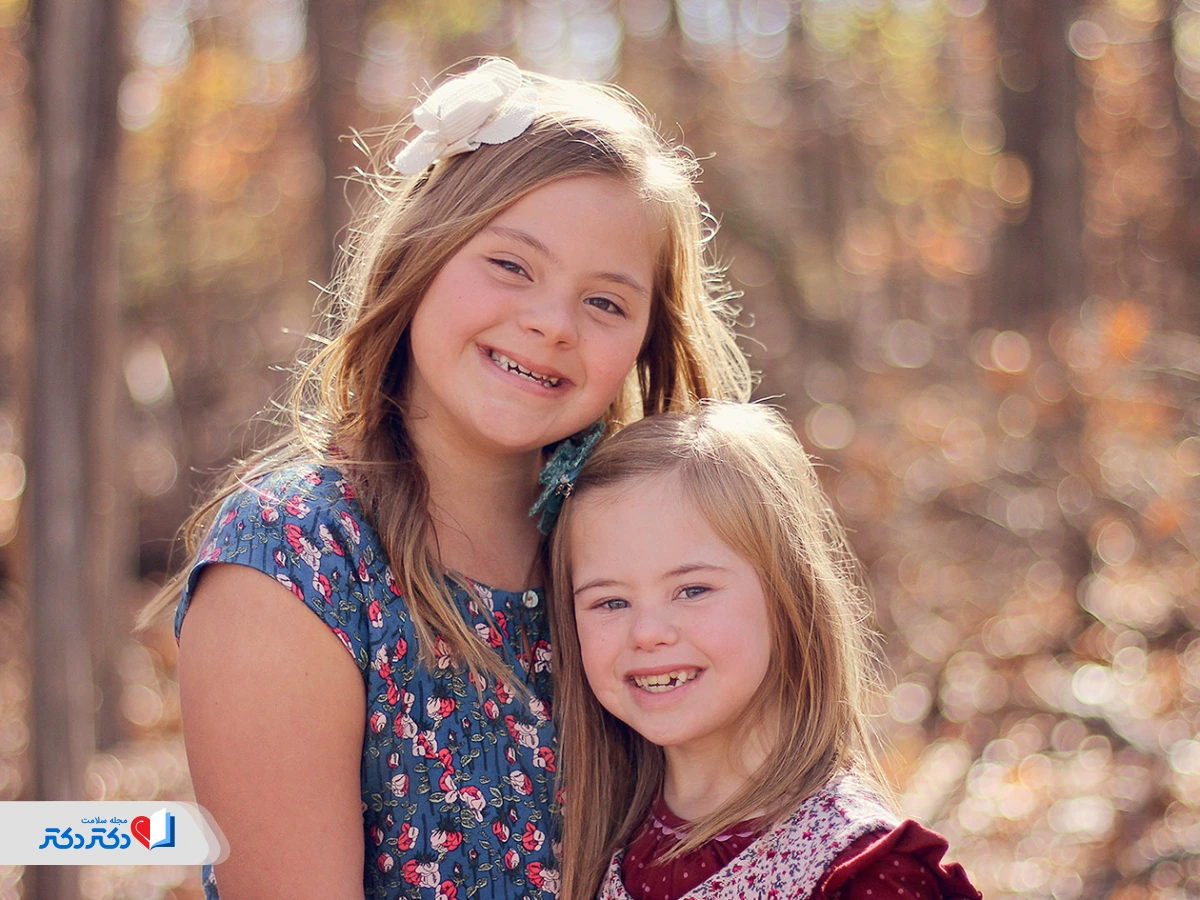 ازدواج در سندرم داون