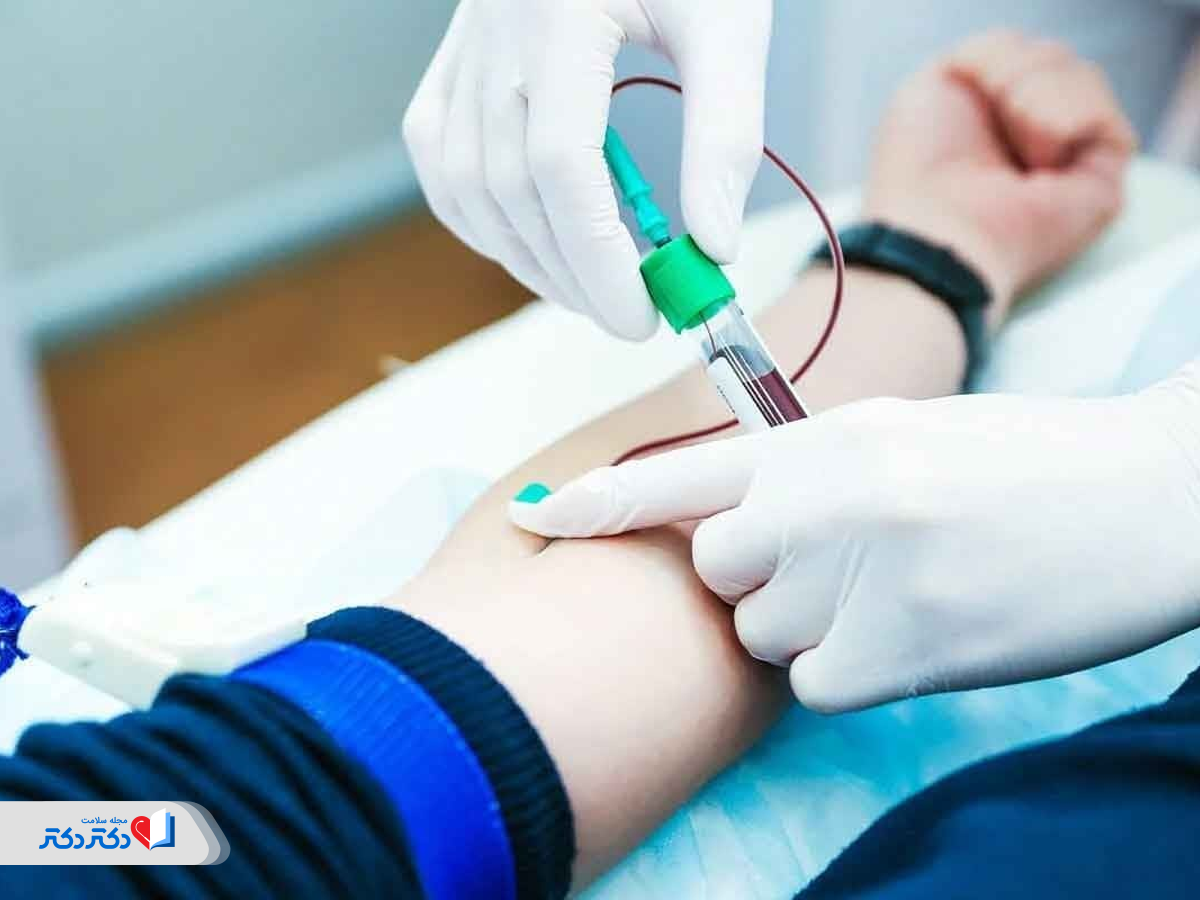 تست خون قبل‌از جراحی لیپوساکشن