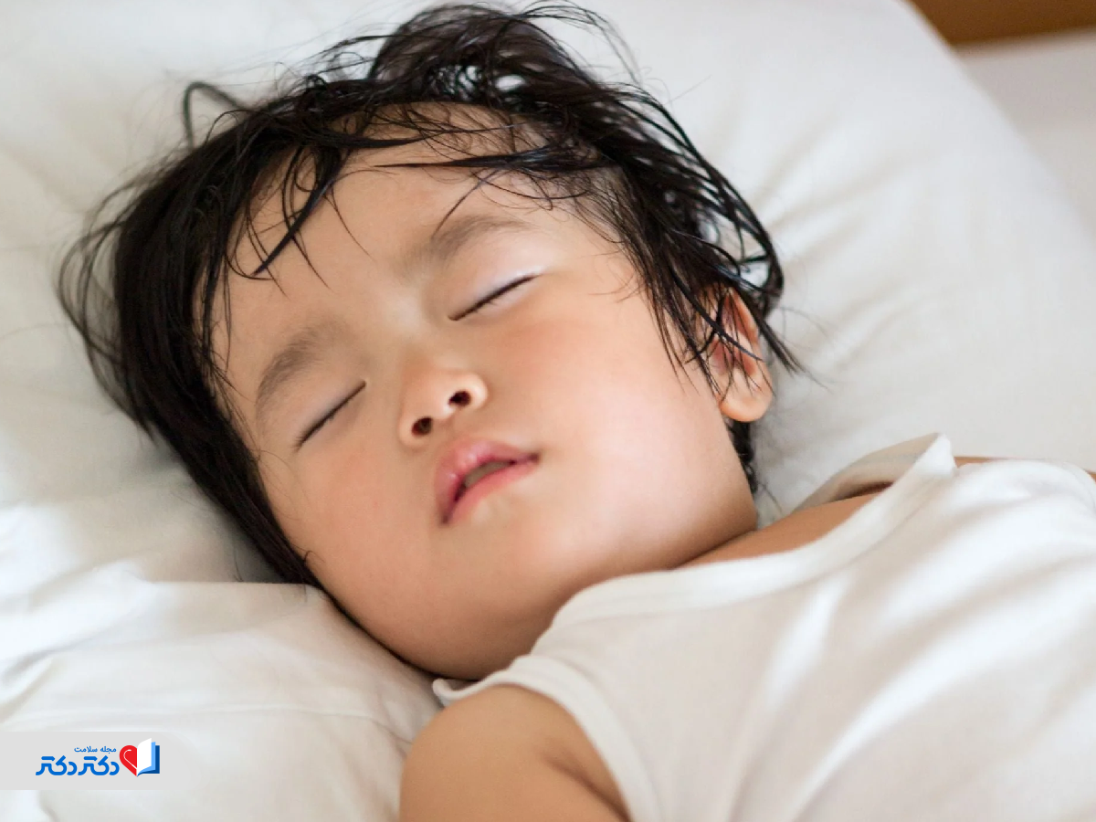 علت تعریق شبانه در کودکان