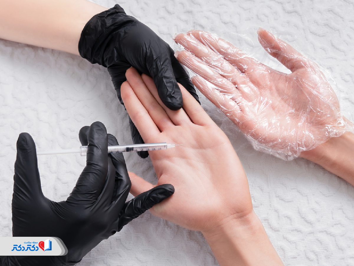بوتاکس برای درمان عرق کف دست