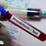 راهنمای کامل PCT در آزمایش خون: تفسیر نتایج و نکات مهم