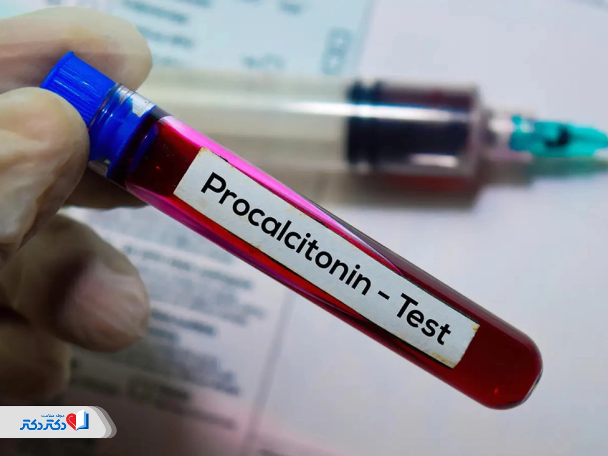 راهنمای کامل PCT در آزمایش خون: تفسیر نتایج و نکات مهم