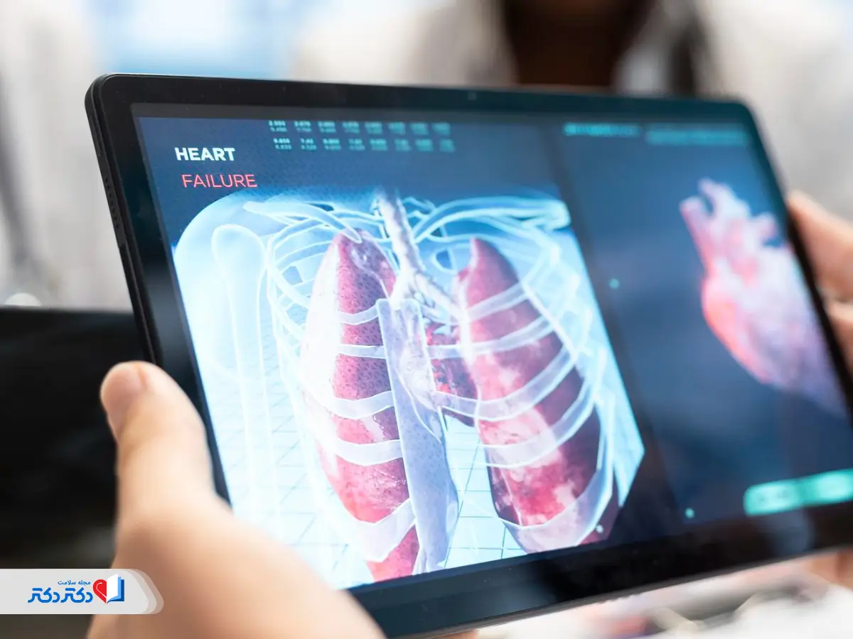 فیبروز ریه چیست و چگونه ایجاد میشود؟