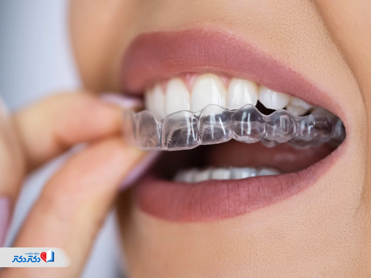 اختلالات خواب و دندان‌قروچه در کودکان