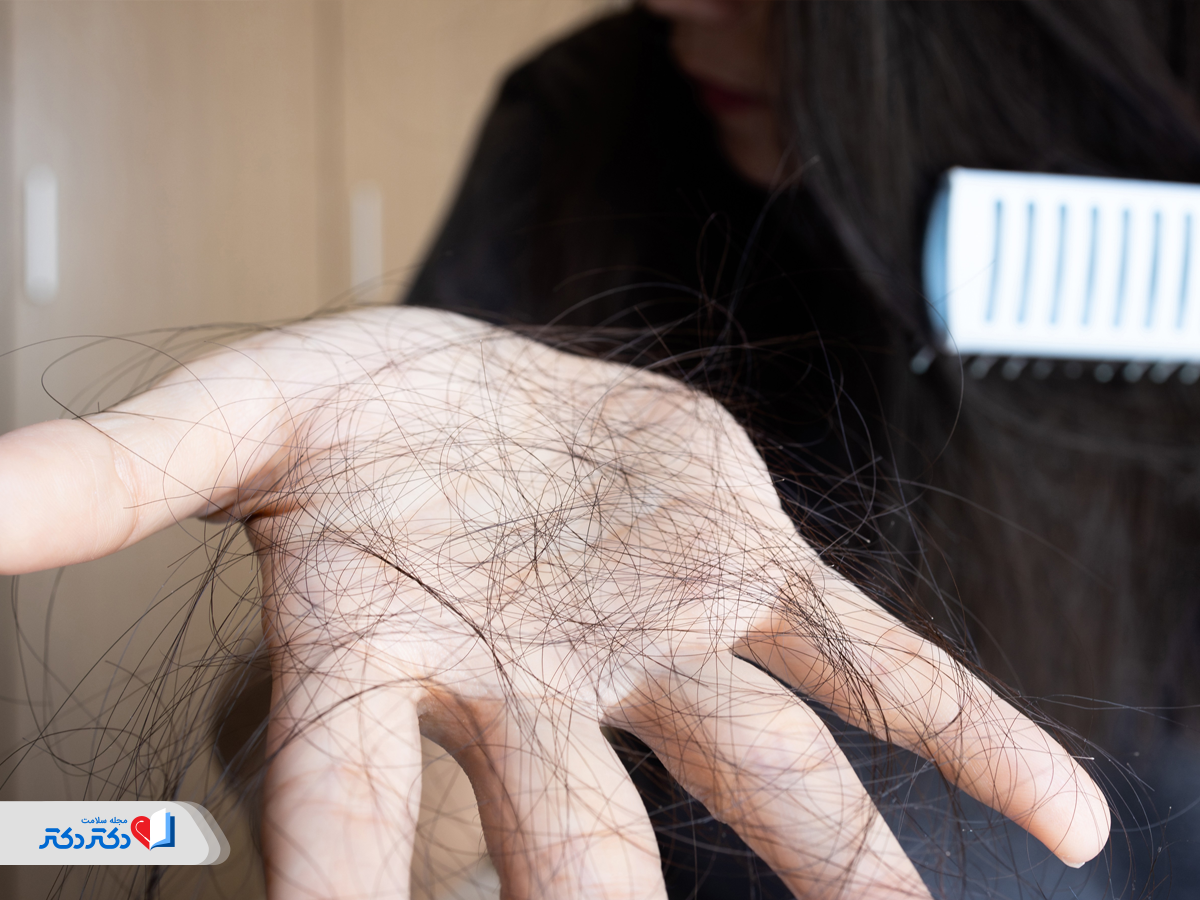 رابطه استرس و ریزش مو