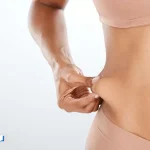 عمل لاغری ابدومینوپلاستی : تجربه بیماران، هزینه‌ها، عوارض و هرچه باید بدانید