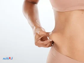 عمل لاغری ابدومینوپلاستی : تجربه بیماران، هزینه‌ها، عوارض و هرچه باید بدانید