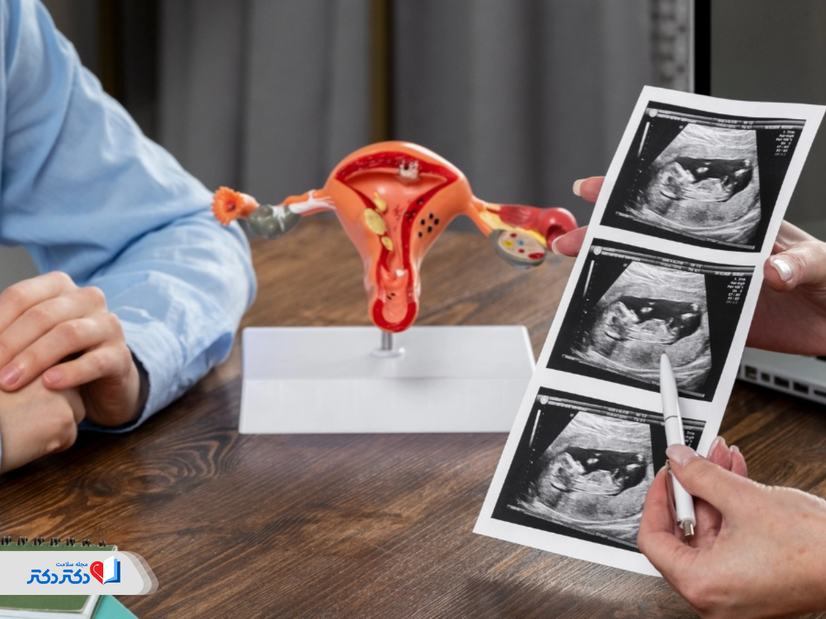 علت سرطان آندومتر