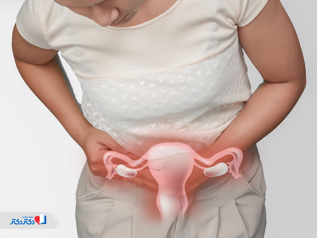 علت سرطان آندومتر