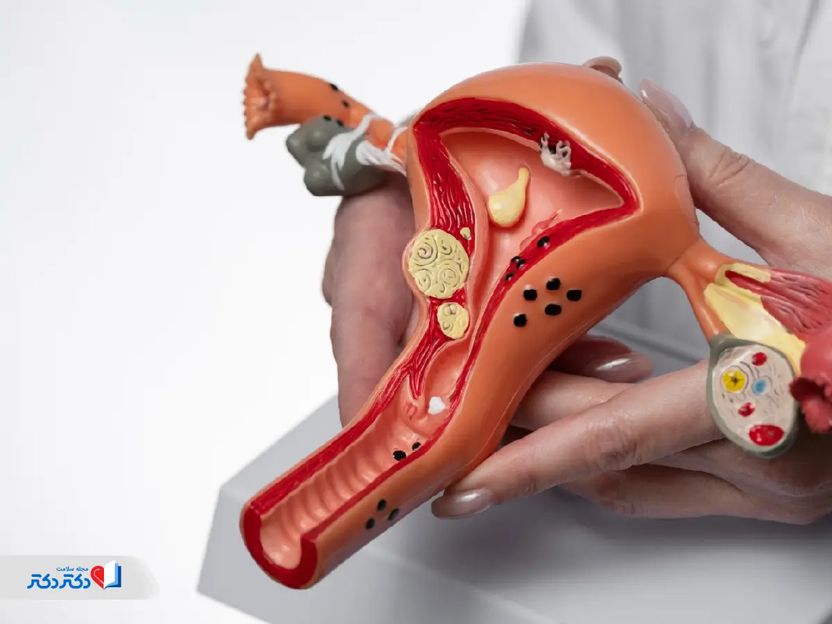 عکس عفونت باکتریایی واژن