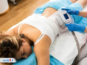 کول اسکالپتینگ:آشنایی با لاغری غیرتهاجمی با تکنولوژی سرد