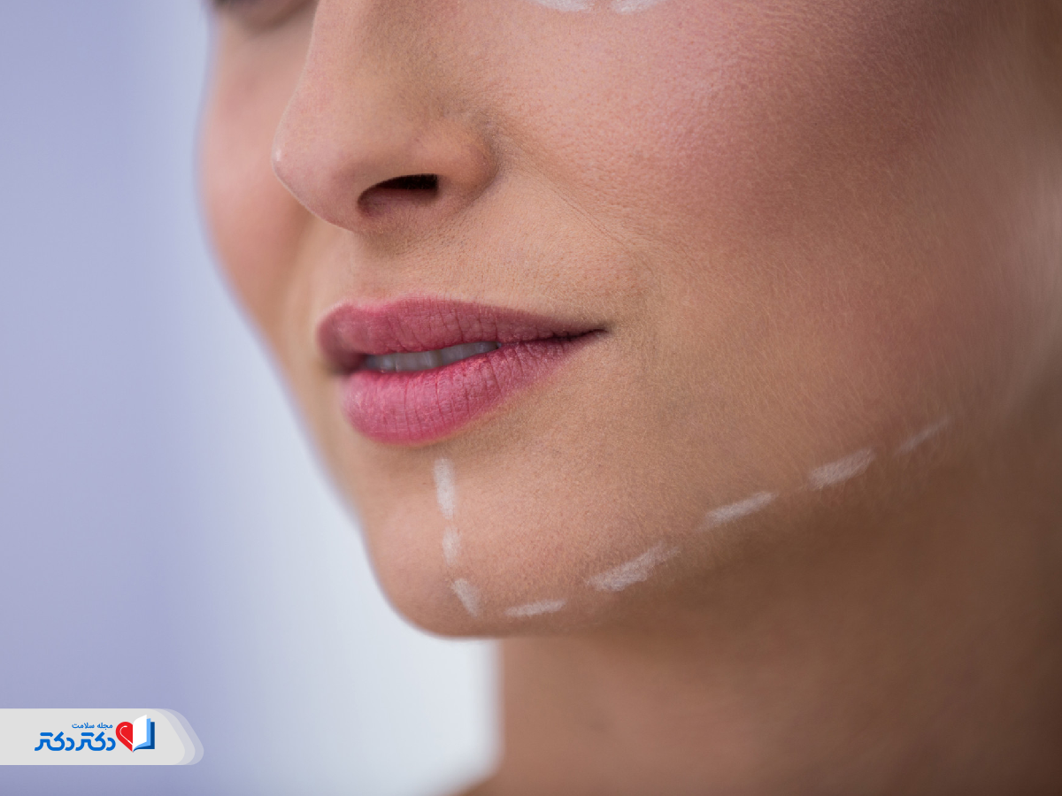 هزینه لیپوساکشن غبغب