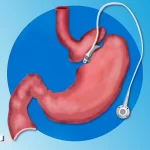 حلقه معده چیست؟ آشنایی با مزایا، عوارض و هزینه‌های آن