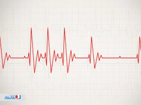 روش‌‌های درمان تپش قلب را بشناسید