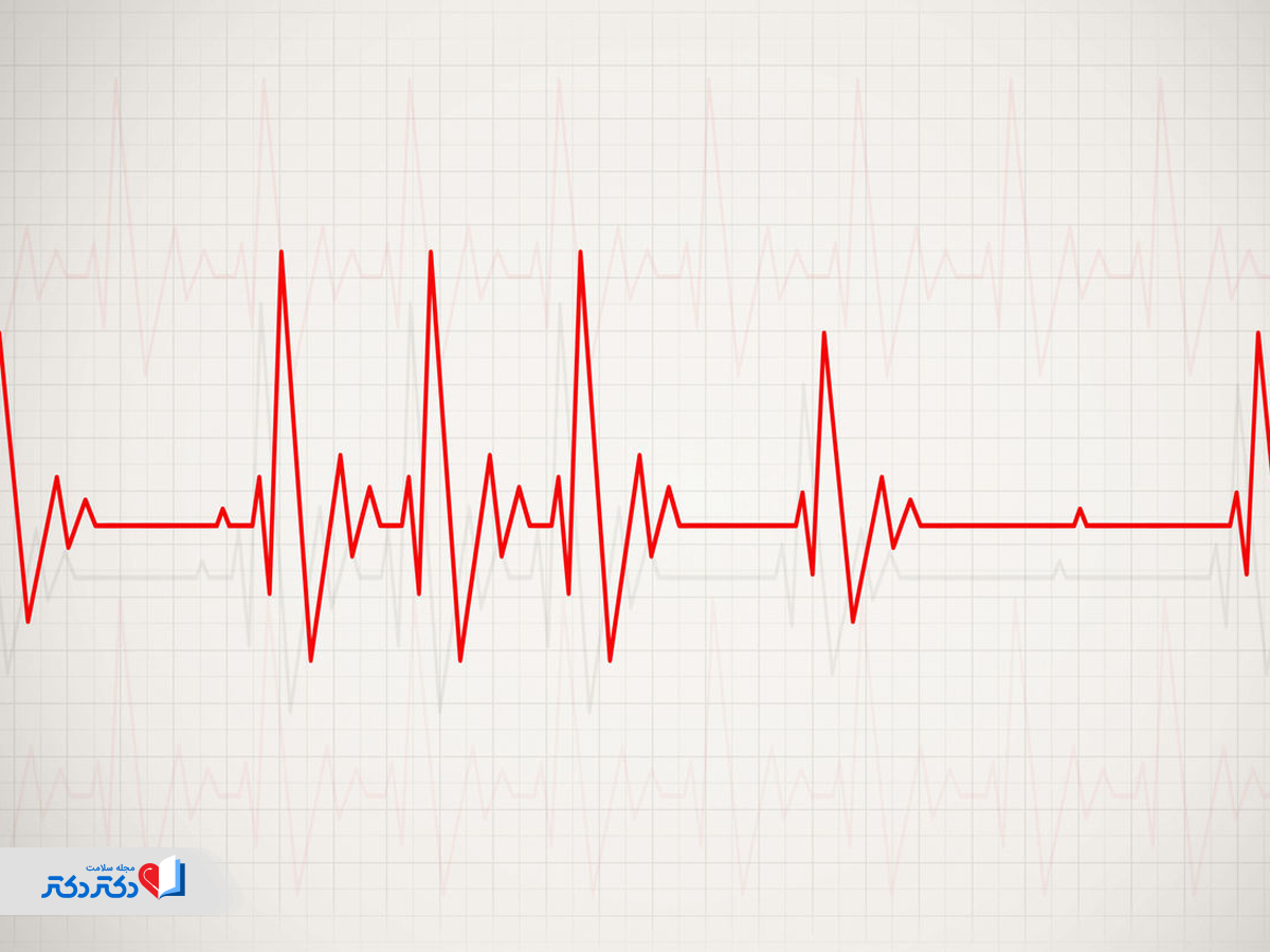 روش‌های درمان تپش قلب