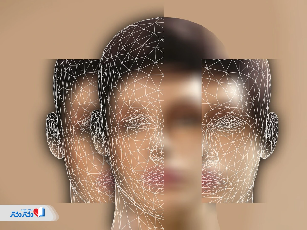 تفاوت اسکیزوئید با اختلالات مشابه