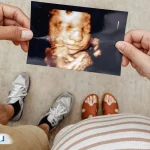 سونوگرافی سه‌بعدی جنین؛ مشاهده چهره و اندام نوزاد