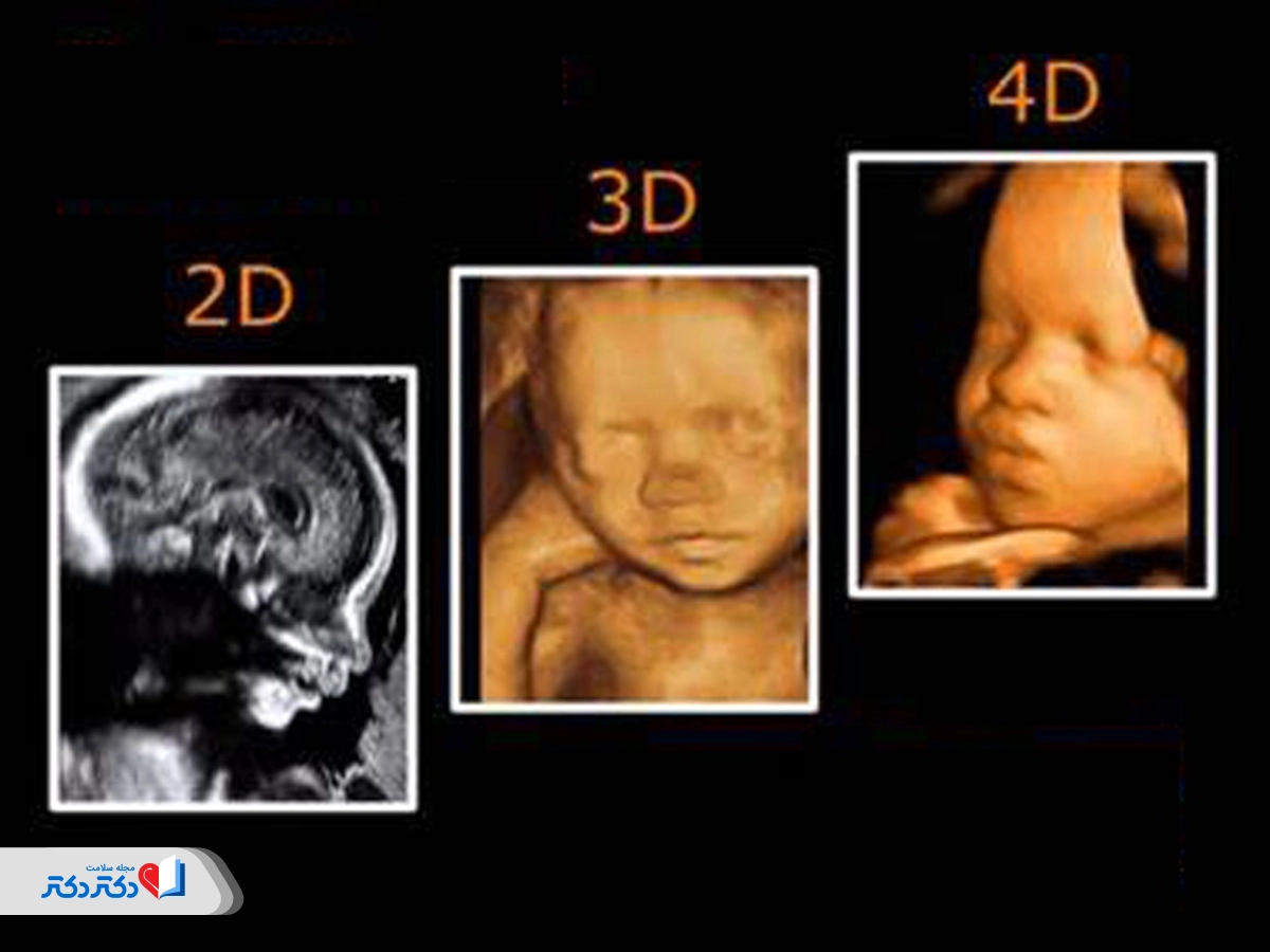 تفاوت سونوگرافی سه‌بعدی با سونوگرافی دوبعدی و چهاربعدی