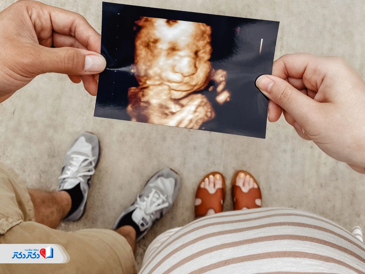 سونوگرافی سه‌بعدی جنین